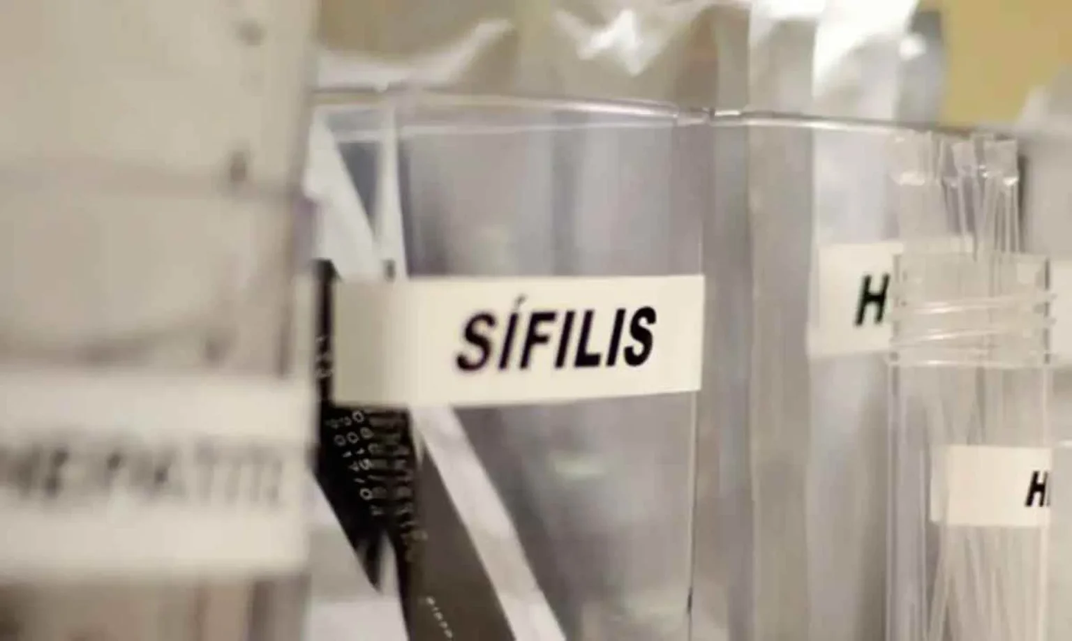 Carnaval e Saúde: Proteja-se do HIV e das ISTs Durante a Folia