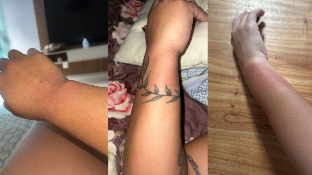 Fãs de Luan Santana em BH Relatam Queimaduras por Pulseiras: 'Ardia Muito'