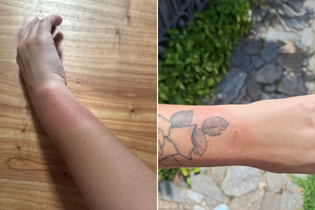 Fãs Relatam Queimaduras após Show de Luan Santana em Belo Horizonte